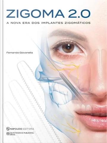 Capa do livro Zigoma 2.0